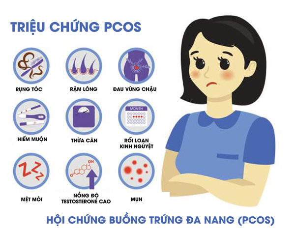 Triệu chứng của buồng trứng đa nang