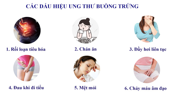 Triệu Chứng Của Ung Thư Buồng Trứng