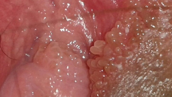 gai sinh nữ xuất hiện khi nào?