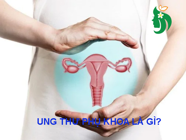 ung thư phụ khoa là gì?