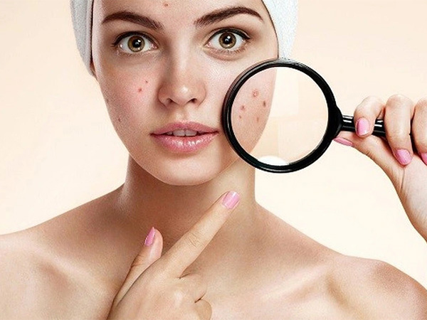 Hướng dẫn chi tiết các bước skincare da mụn hiệu quả nhất