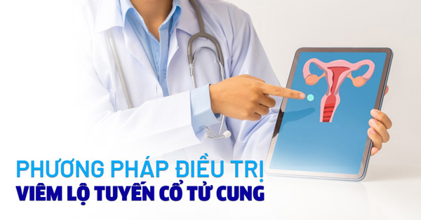 Cách điều trị viêm lộ tuyến cổ tử cung hiệu quả