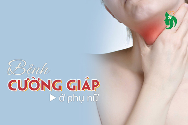 Bệnh cường giáp ở phụ nữ: Nguyên nhân, triệu chứng và cách điều trị hiệu quả