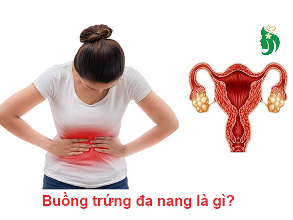 Buồng trứng đa nang: Nguyên nhân, triệu chứng và cách điều trị hiệu quả