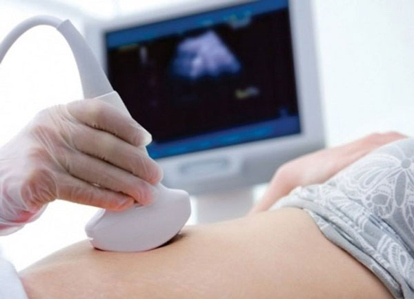 chẩn đoán và điều trị buồng chứng đa nang