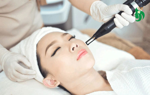 Điều trị nám bằng laser có an toàn không?