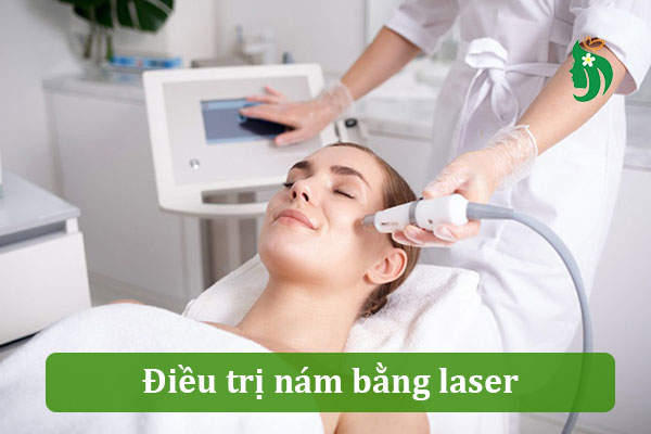 Điều trị nám bằng laser có an toàn không?