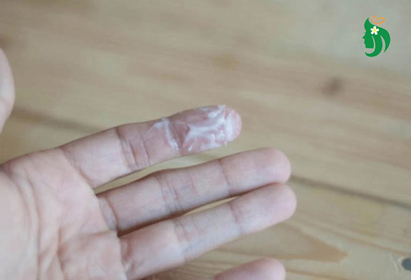 Cách xử lý khi bị huyết trắng ra nhiều