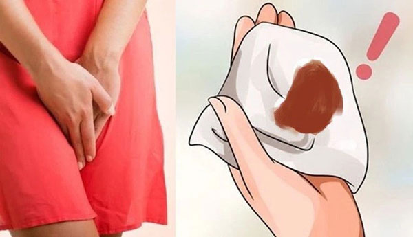 Nguyên nhân khiến kinh nguyệt màu nâu