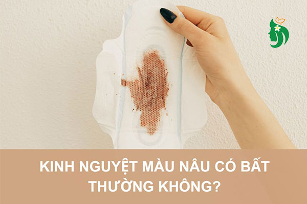 Kinh nguyệt màu nâu: Nguyên nhân, cảnh báo sức khỏe và cách xử lý
