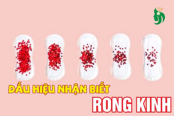 Dấu hiệu nhận biết rong kinh kéo dài
