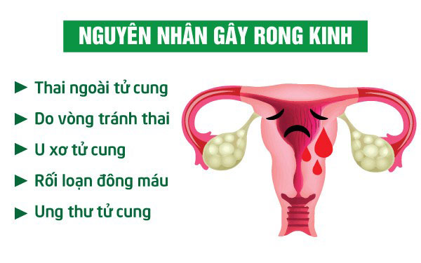 Nguyên nhân gây chảy máu kinh nguyệt kéo dài