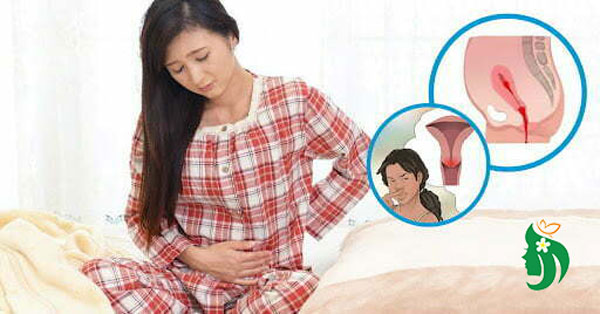 Sản dịch sau sinh kéo dài bao lâu?