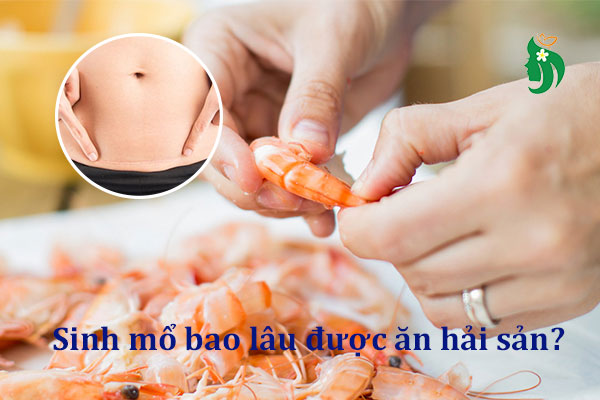 Sinh mổ bao lâu được ăn hải sản? Chuyên gia giải đáp chi tiết