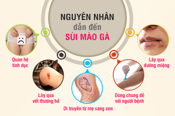 Nguyên nhân gây sùi mào gà ở nữ giới