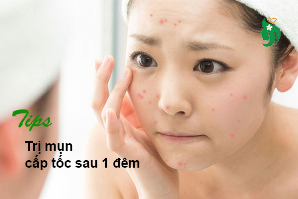 Trị mụn cấp tốc sau 1 đêm: Giải pháp hiệu quả cho làn da sạch mụn