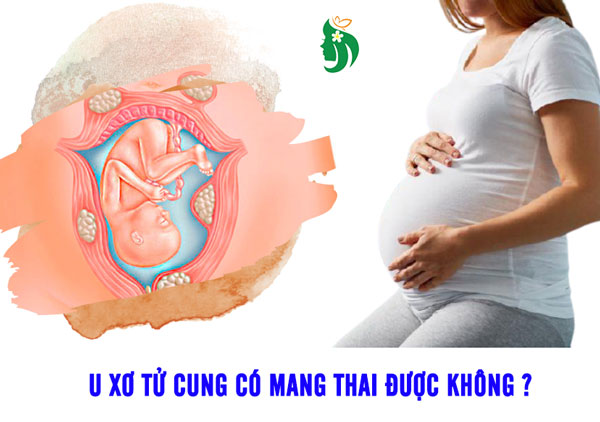 U xơ tử cung ảnh hưởng như thế nào đến việc mang thai?