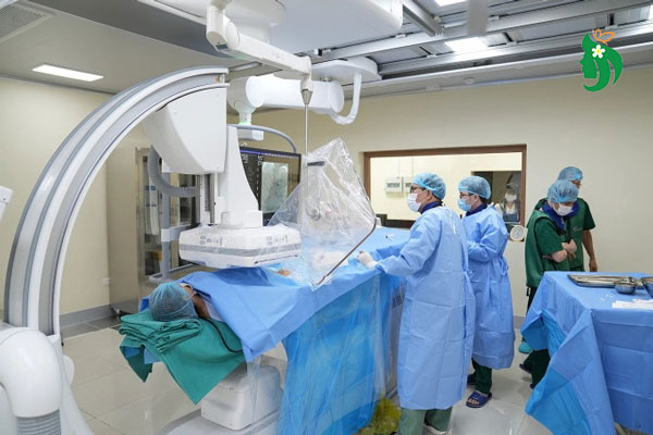 Có nên lựa chọn nút mạch không?