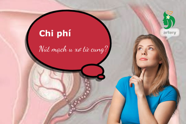 Chi phí nút mạch u xơ tử cung: Thông tin cần biết trước khi điều trị