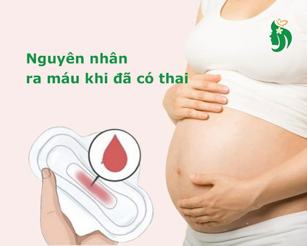 Một số nguyên nhân ra máu khi đã có thai