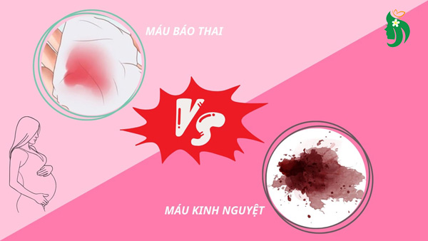 Phân biệt máu kinh và máu báo thai