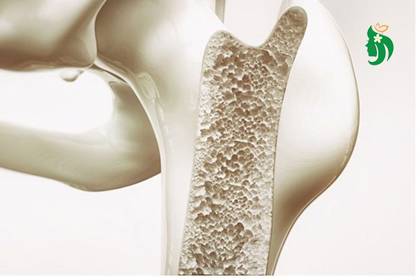 Đo loãng xương bao nhiêu tiền? Chi phí & thông tin cần biết từ chuyên gia