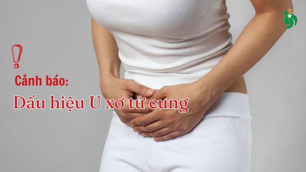 Dấu hiệu cảnh báo u xơ tử cung