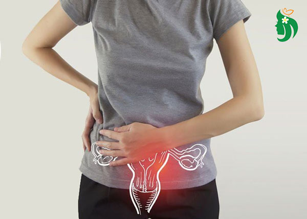 U xơ tử cung khi nào cần điều trị bằng thuốc?