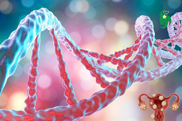 U xơ tử cung có di truyền không? Chuyên gia giải đáp từ A đến Z