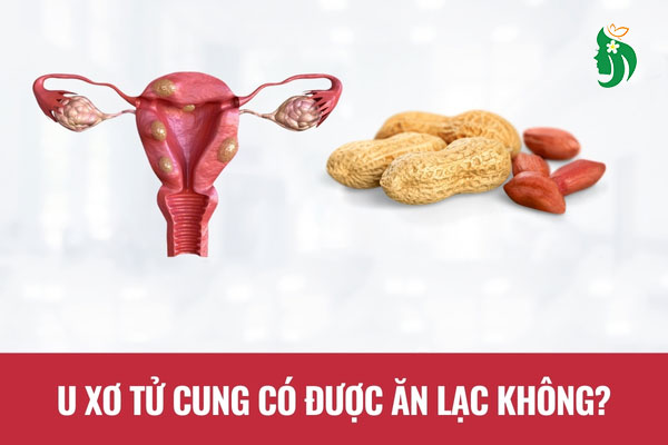 U xơ tử cung có được ăn lạc không?