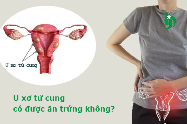 U xơ tử cung có được ăn trứng không? Giải đáp từ chuyên gia