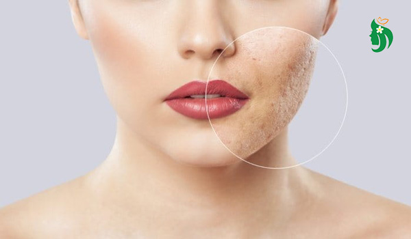 Nhận diện: Khi nào da đang “kêu cứu”?