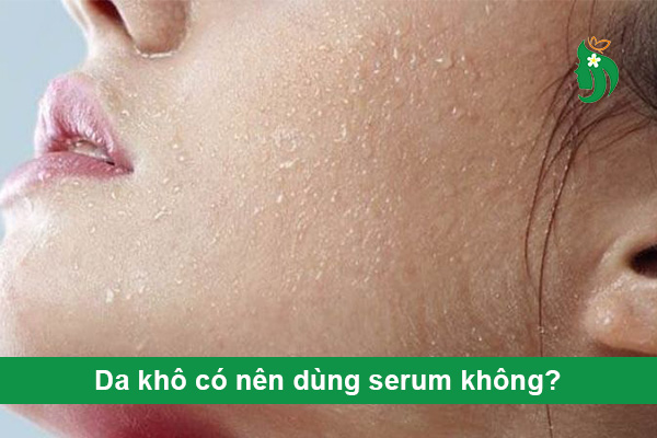 Da khô có nên dùng serum không?