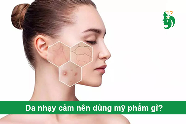 Da nhạy cảm nên dùng mỹ phẩm gì?