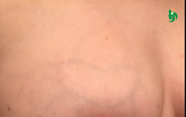 Hình ảnh nhũ hoa khi mới mang thai: Những thay đổi dễ nhận thấy