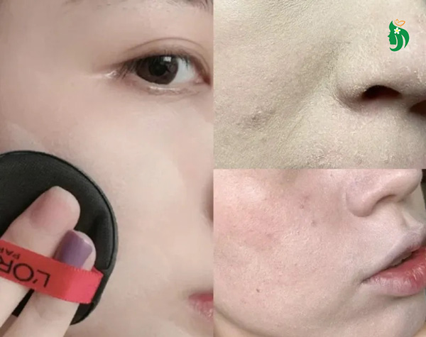 Da bị mốc khi makeup là gì?