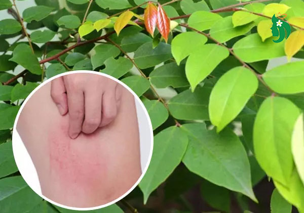 Lá khế – Giảm mẩn ngứa, dị ứng da