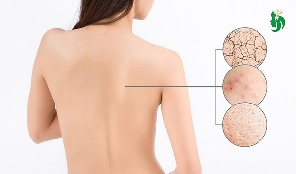 Tẩy da chết mấy lần 1 tuần là tốt? – Gợi ý theo từng loại da