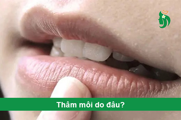 Thâm môi do đâu? Checklist thói quen xấu khiến môi sạm màu