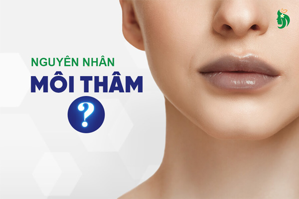 nguyên nhân gây thâm môi do đâu?
