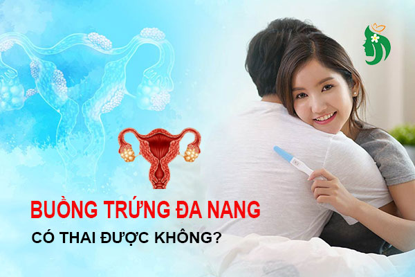 Bị buồng trứng đa nang có thai được không?