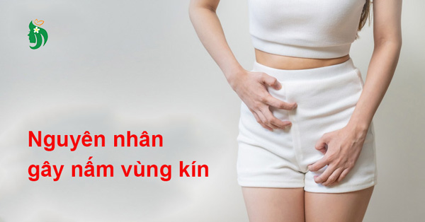 Nguyên nhân gây nấm vùng kín