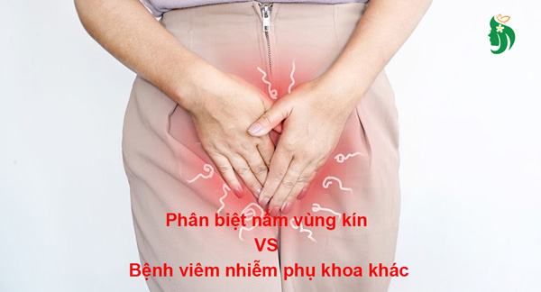 Cách phân biệt nấm vùng kín với các bệnh viêm nhiễm phụ khoa khác