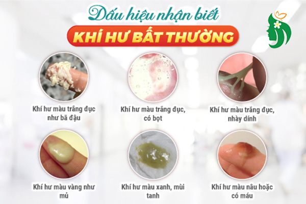 Nhận biết khí hư bất thường qua màu sắc