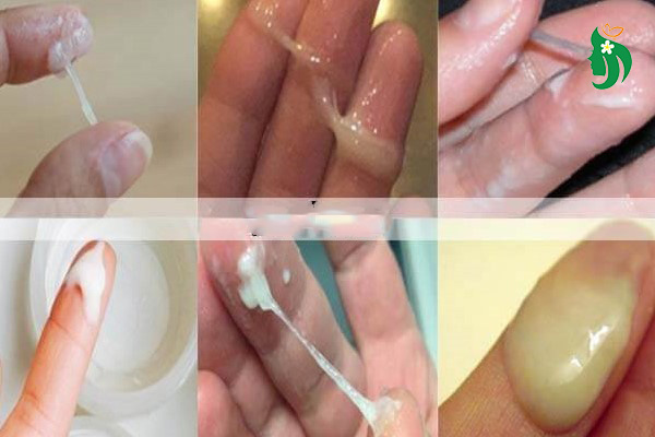 Khí hư bất thường là biểu hiện của bệnh gì?
