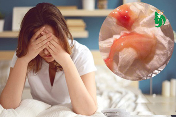 Khí Hư Có 1 Ít Sợi Máu - Điều Chị Em Cần Phải Biết!