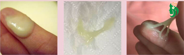 Khí hư màu vàng xanh có đáng lo không?