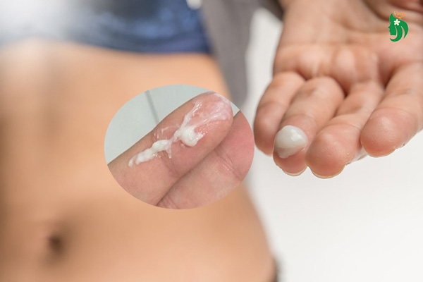 Nguyên nhân gây ra khí hư màu trắng đục