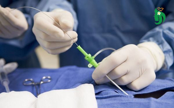 Các phương pháp điều trị viêm lộ tuyến cổ tử cung hiệu quả hiện nay