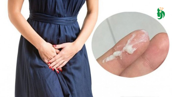Ra nhiều khí hư màu trắng đục có nguy hiểm không?